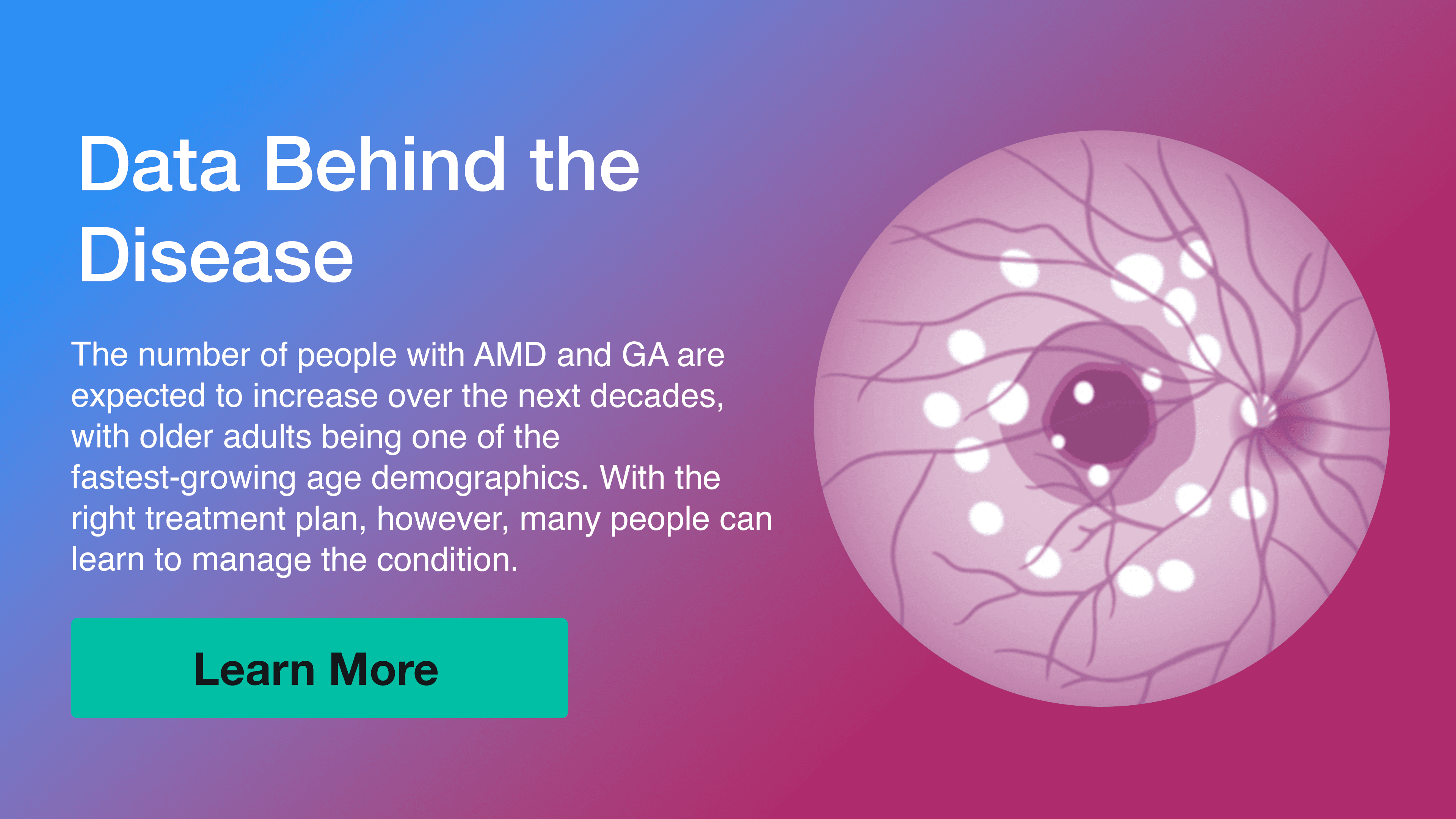 Data Behind the Disease: Geographic Atrophy