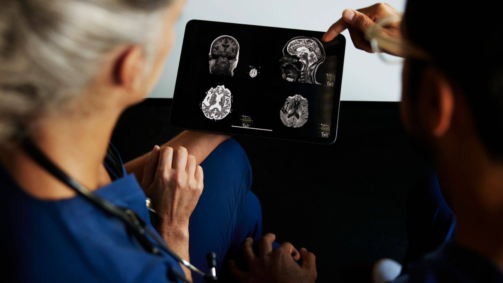 Should you seek a second opinion for a glioma diagnosis?