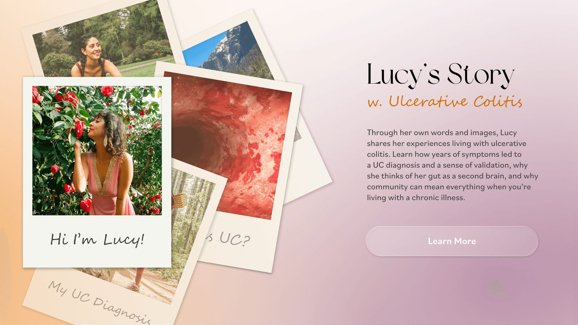 Interactive Patient Story - UC