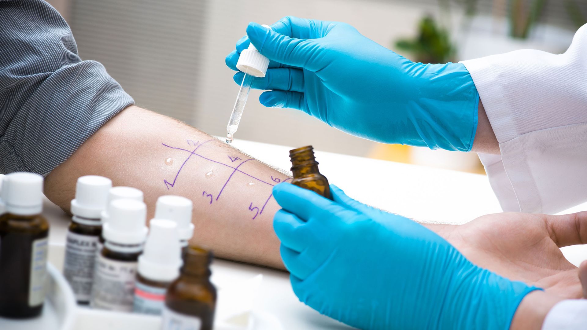 Know before you go: The allergist