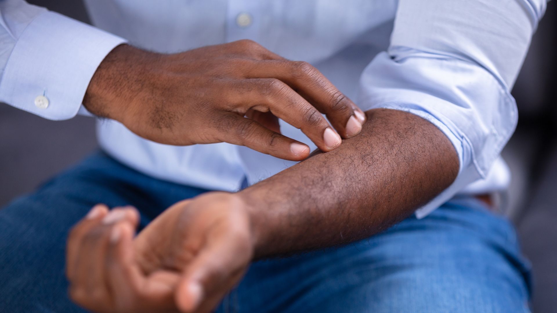 5 psoriasis treatments—and how to choose the right one for you