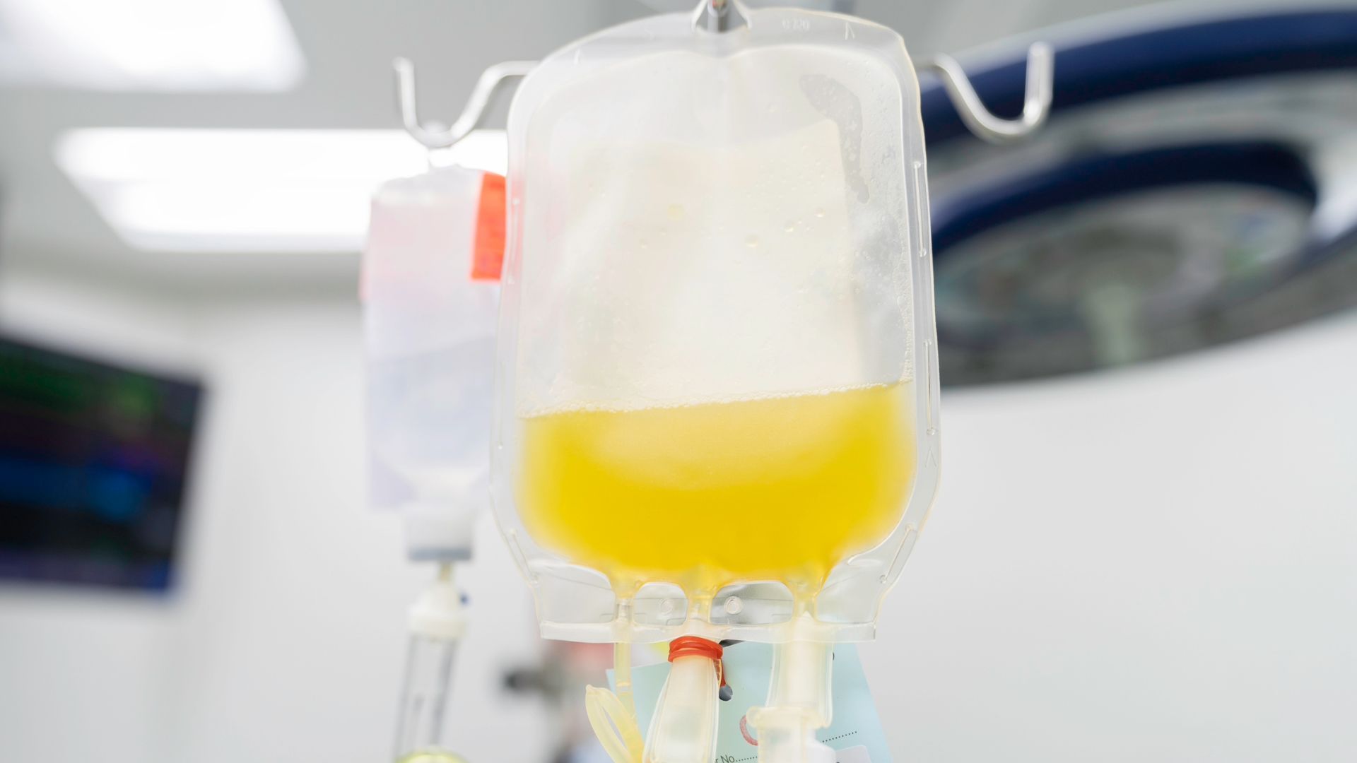 Questions when starting a new therapy for CIDP