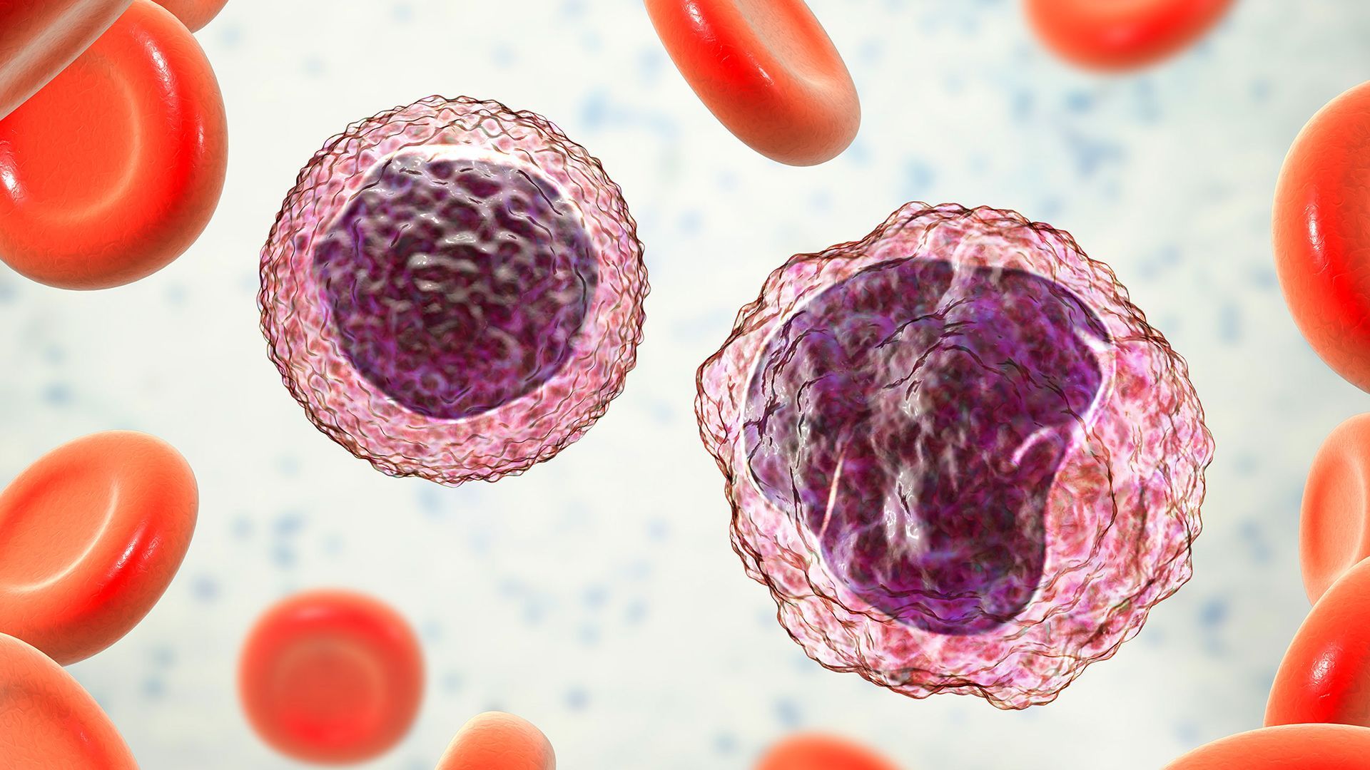 Terms to help understand Waldenstrom macroglobulinemia