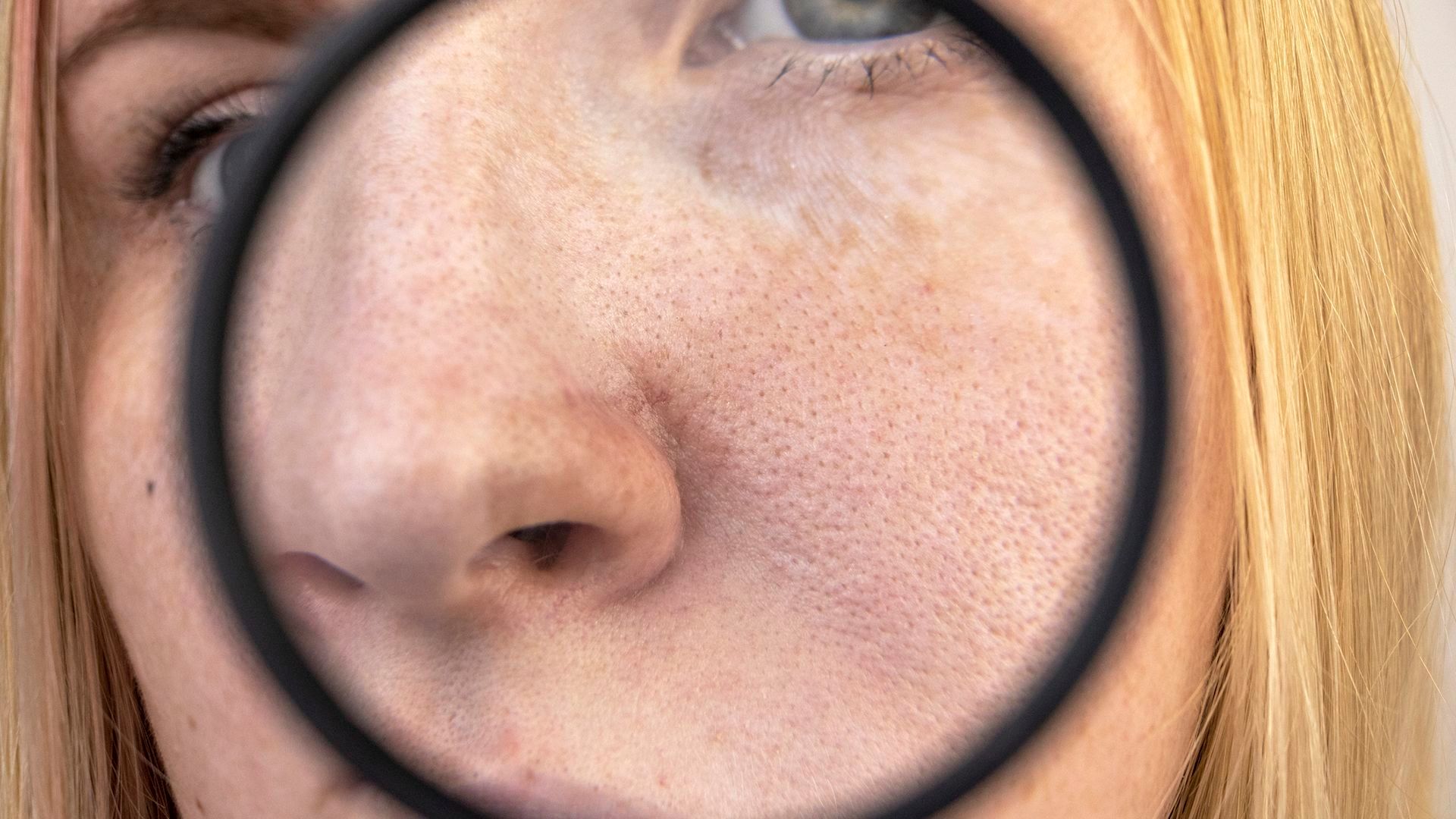 What a dermatologist wants you to know about skin cancer