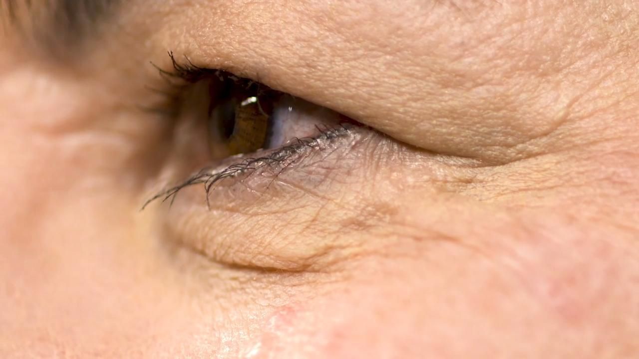 My story, my diagnosis: Nancy's story