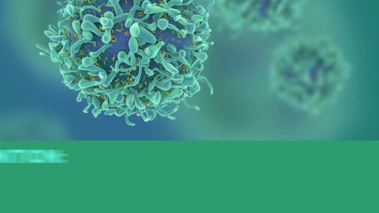What you need to know about multiple myeloma