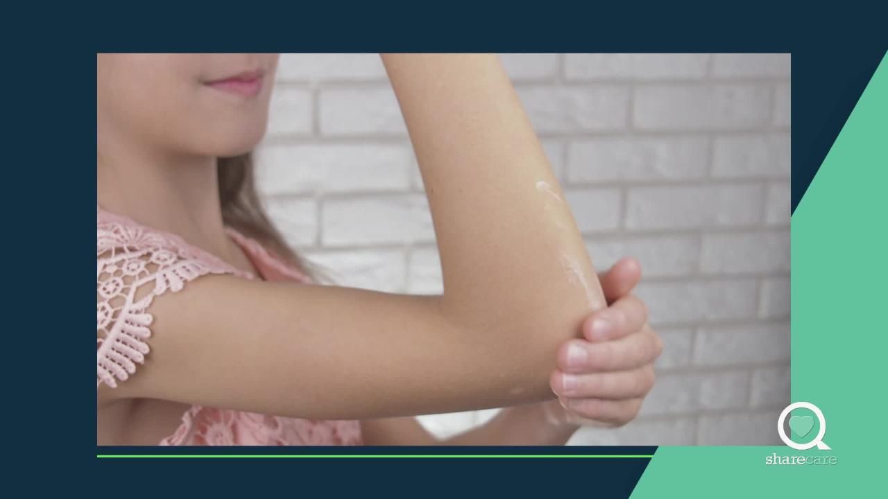 Tips to control pediatric eczema