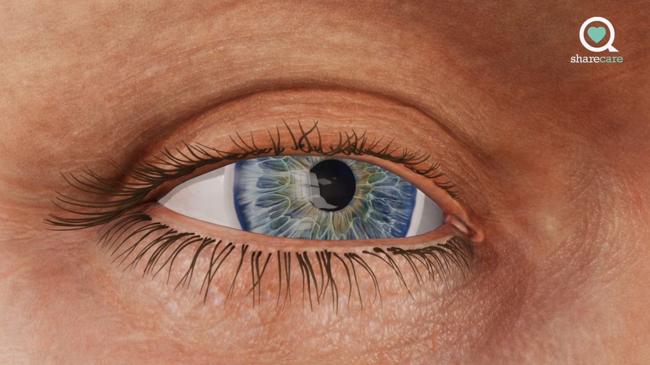 A virtual look at wet AMD