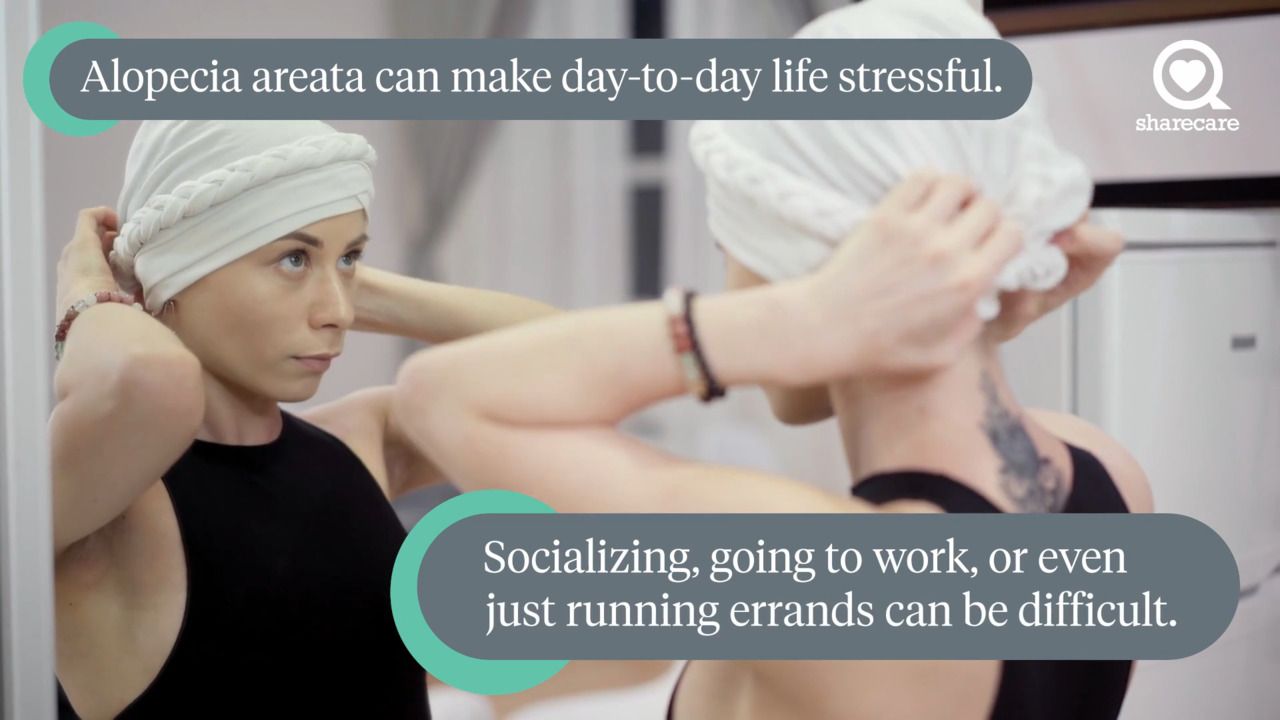 3 ways to cope with the emotional burden of alopecia areata