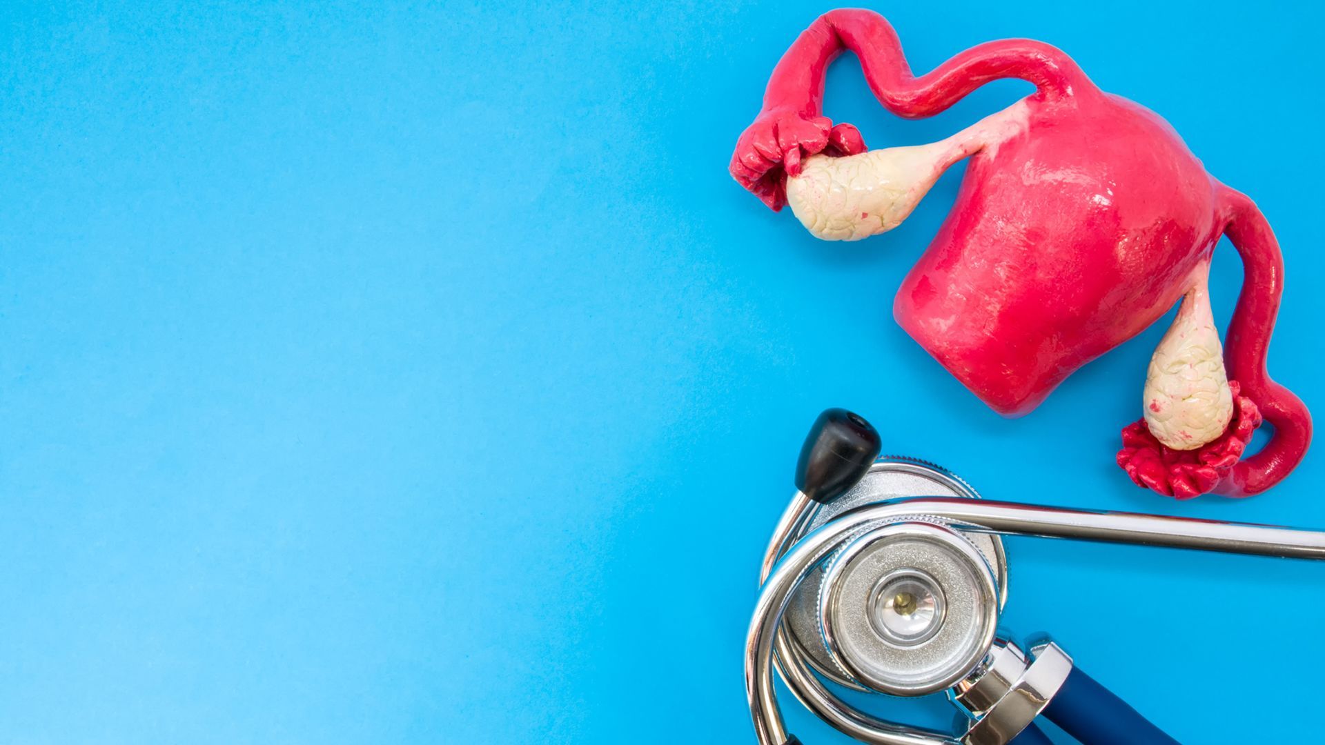 What causes endometriosis?