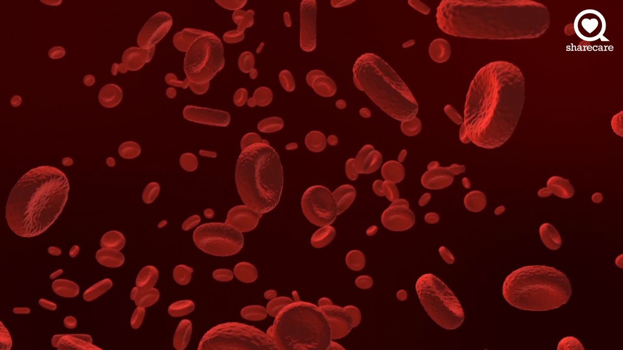 Ask the experts: polycythemia vera